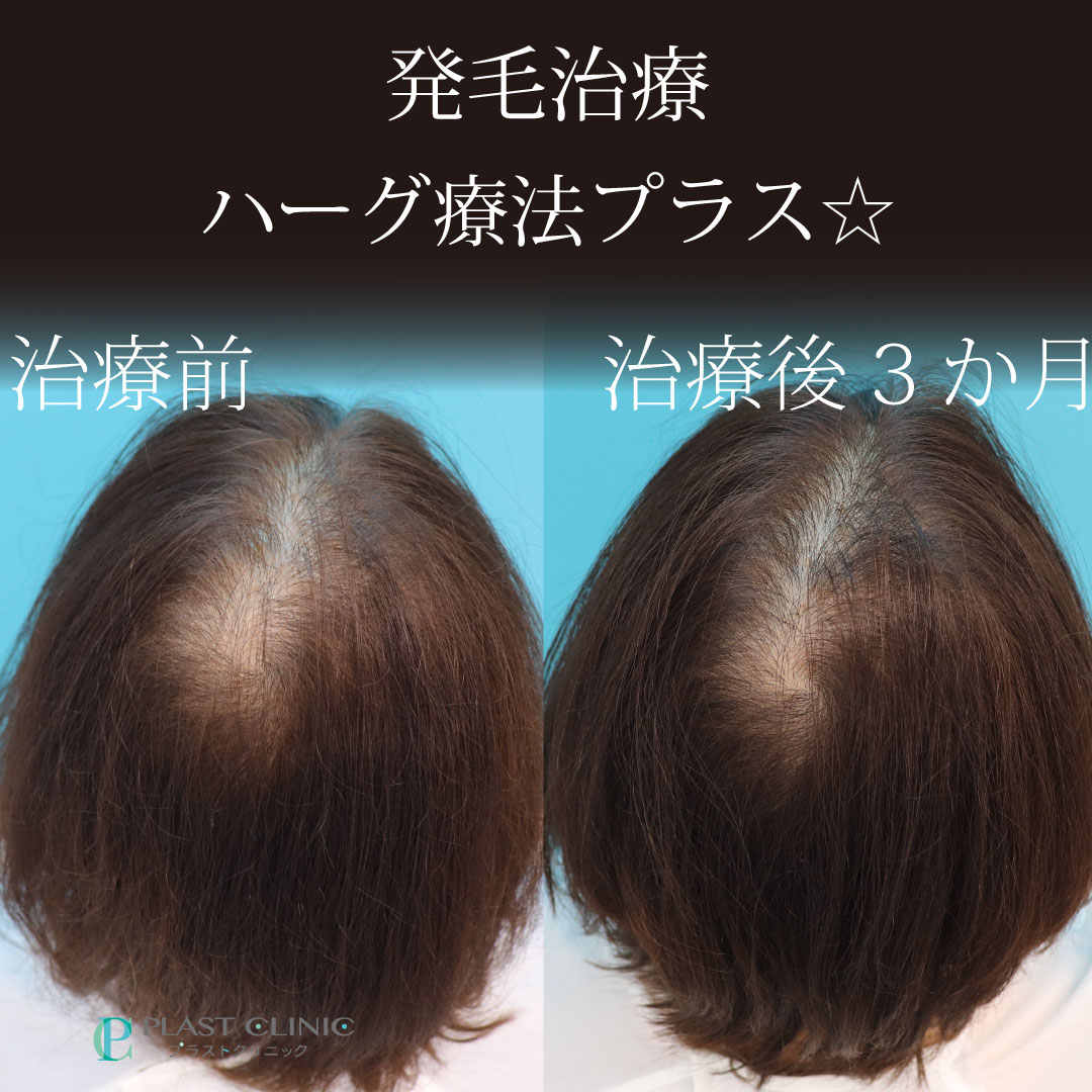 1296ハーグ寺嶋弘子50代.jpg