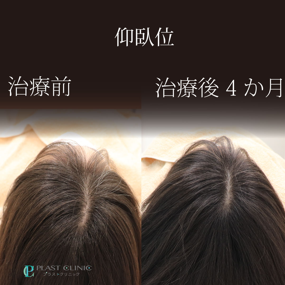 1311ヘアリバイタル北山亜矢子40